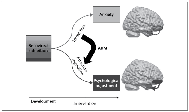 Temperament and Attention as Core Mechanisms in the Early Emergence of Anxiety